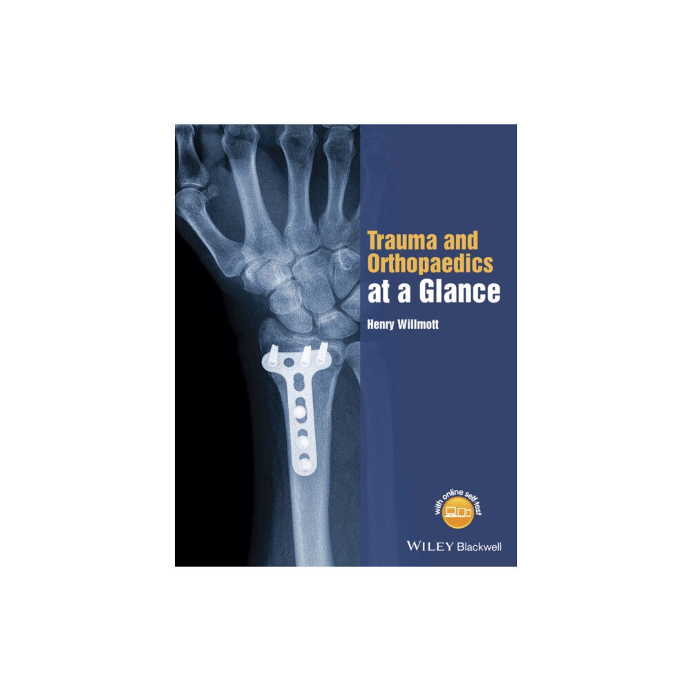 John Wiley And Sons Ltd Trauma and Orthopaedics at a Glance (häftad, eng)