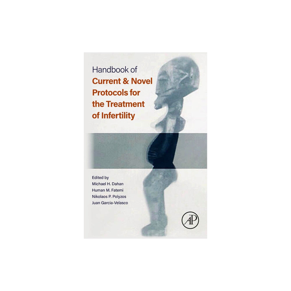 Elsevier Science & Technology Handbook of Current and Novel Protocols for the Treatment of Infertility (häftad, eng)