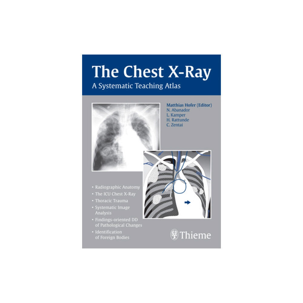 Thieme Publishing Group The Chest X-Ray (häftad, eng)