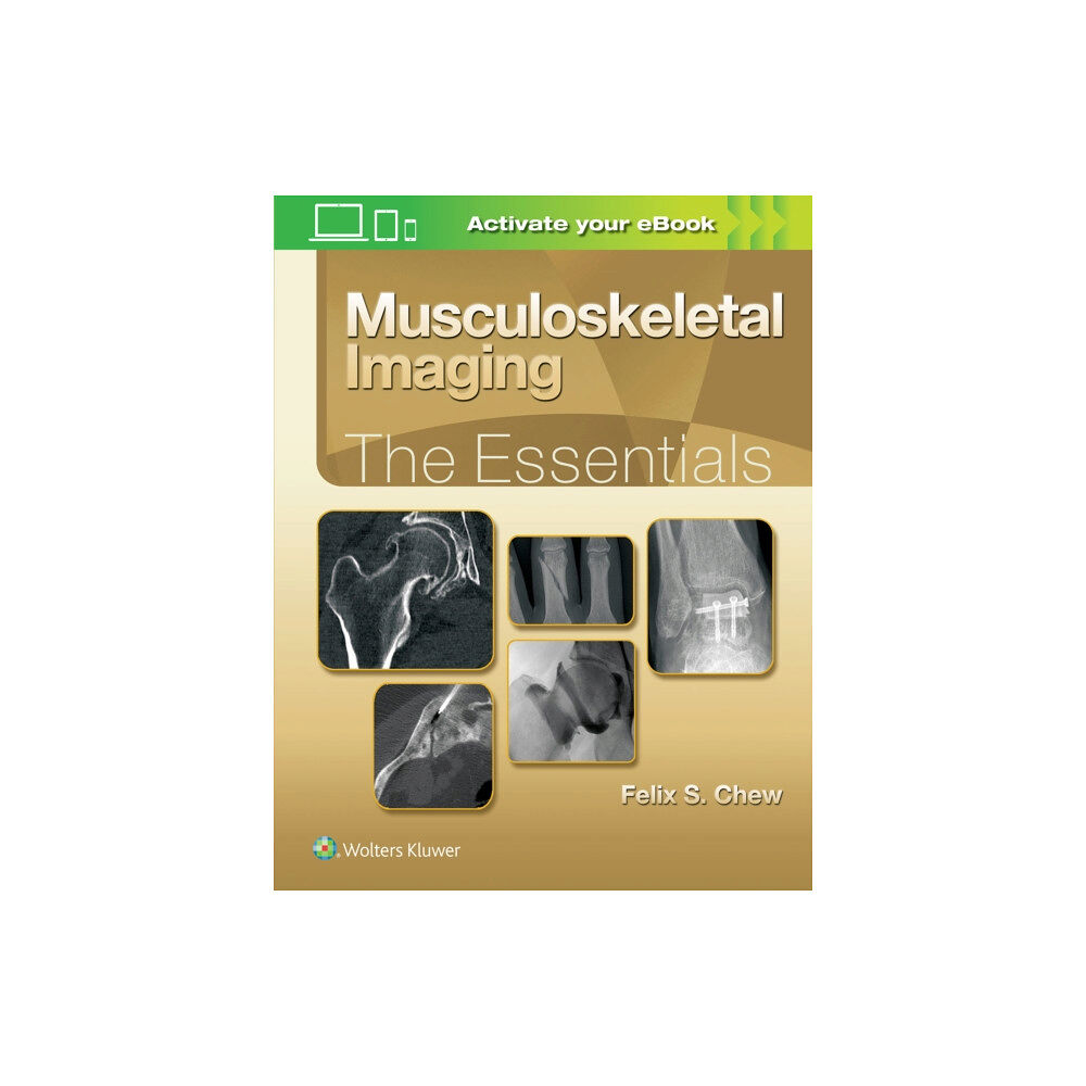 Lippincott Williams and Wilkins Musculoskeletal Imaging: The Essentials (inbunden, eng)