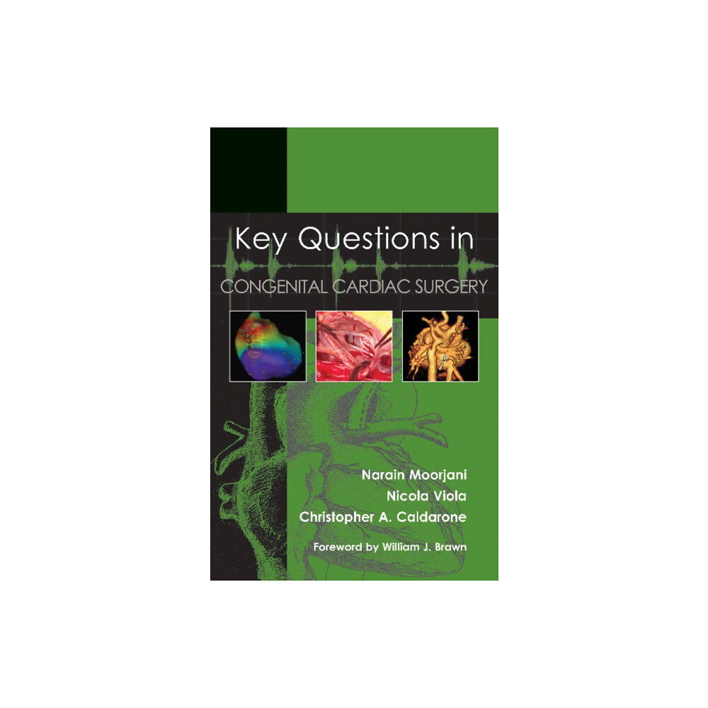 TFM Publishing Ltd Key Questions in Congenital Cardiac Surgery (häftad, eng)