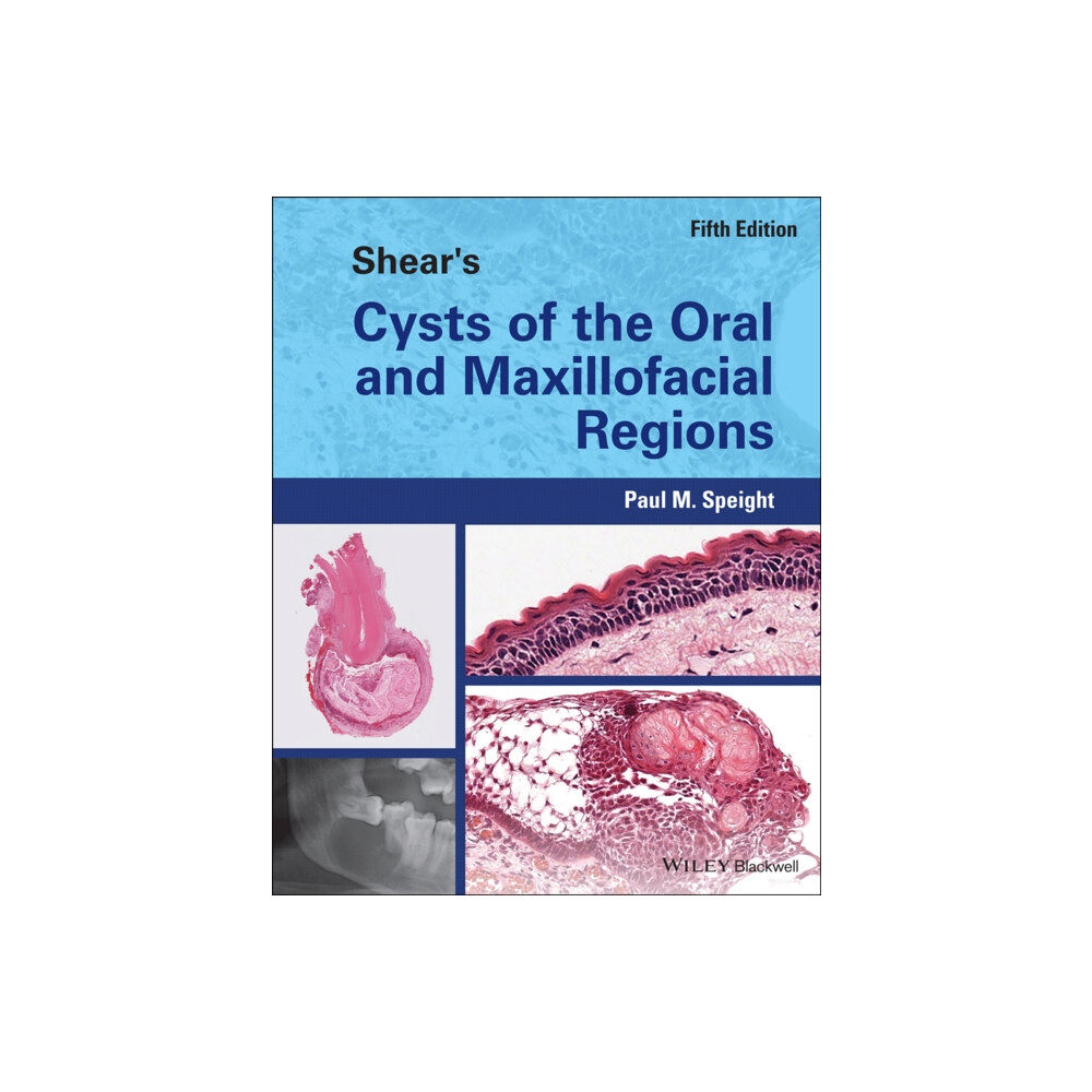 John Wiley And Sons Ltd Shear's Cysts of the Oral and Maxillofacial Regions (inbunden, eng)