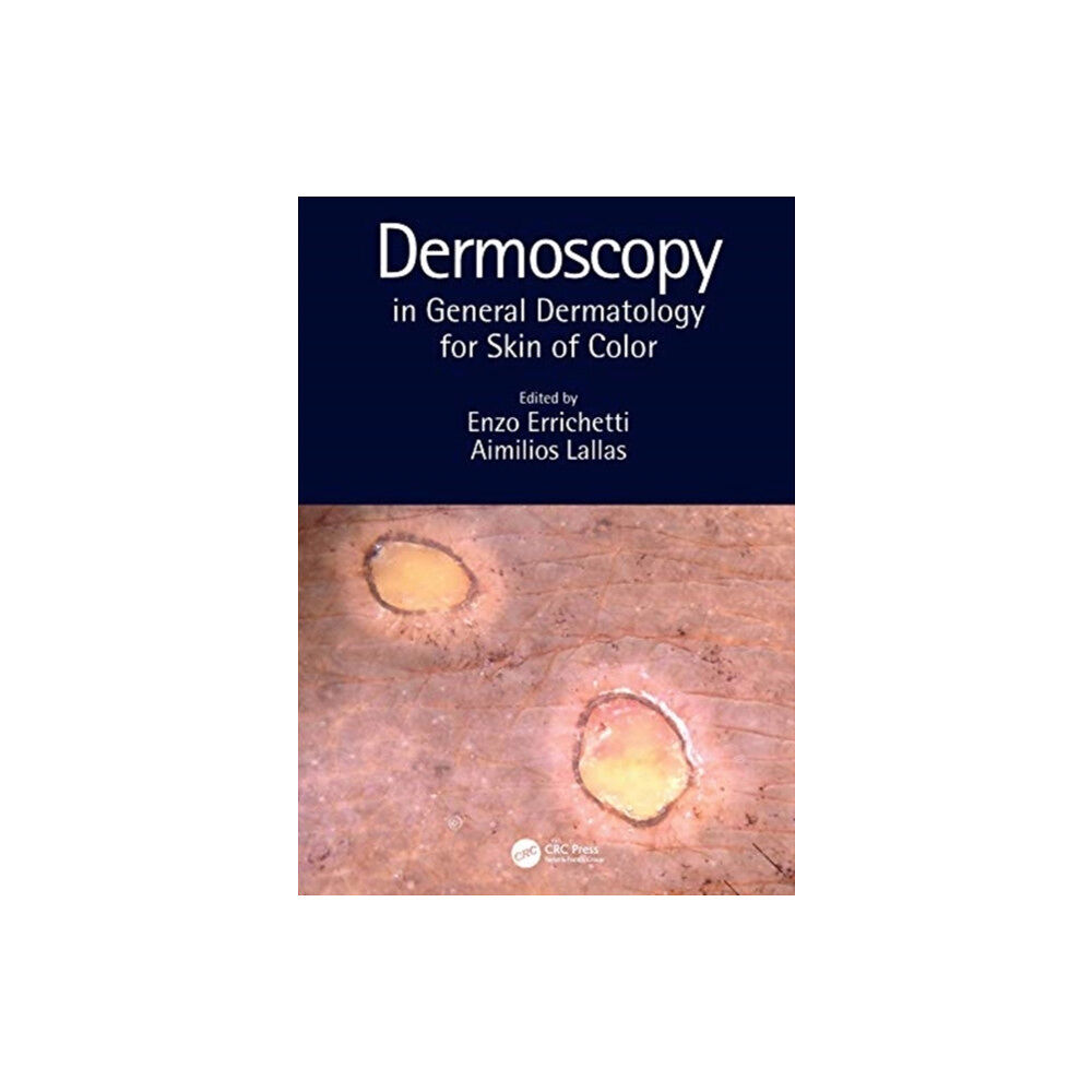 Taylor & francis ltd Dermoscopy in General Dermatology for Skin of Color (inbunden, eng)