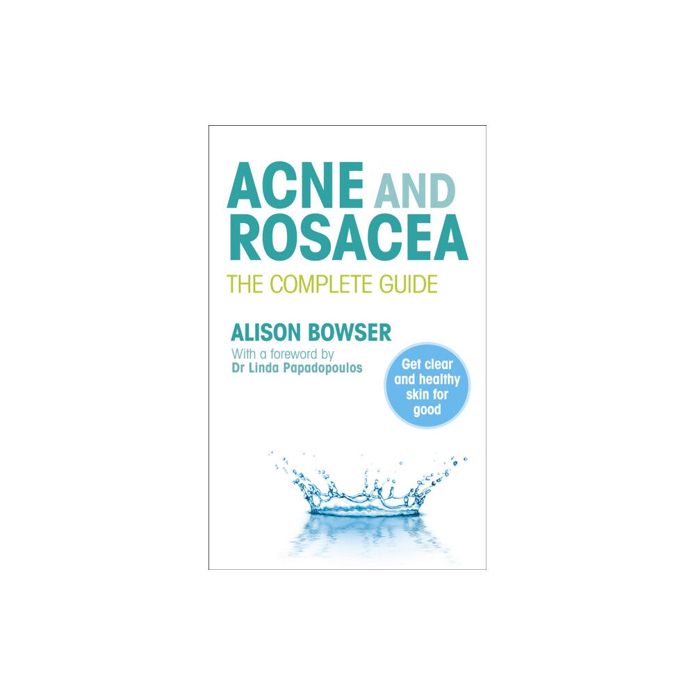 Ebury Publishing Acne and Rosacea (häftad, eng)