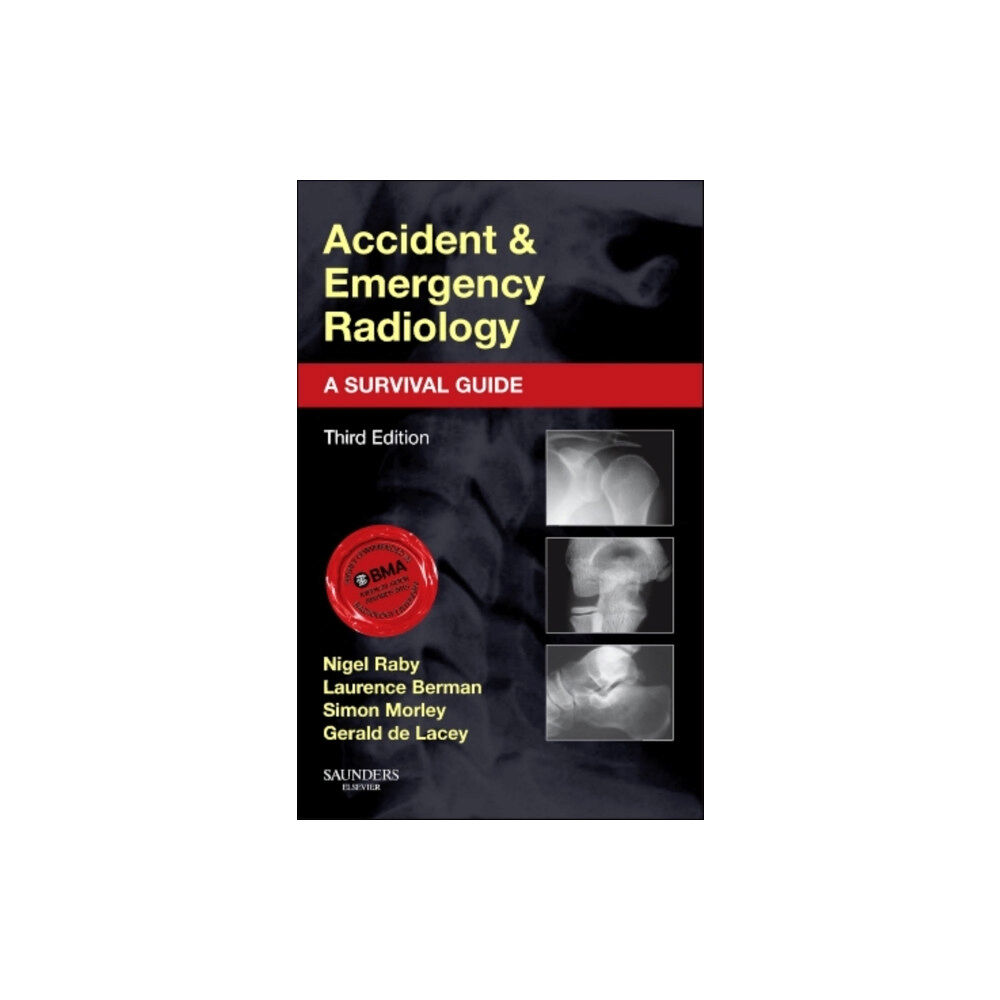 Elsevier Health Sciences Accident and Emergency Radiology: A Survival Guide (häftad, eng)