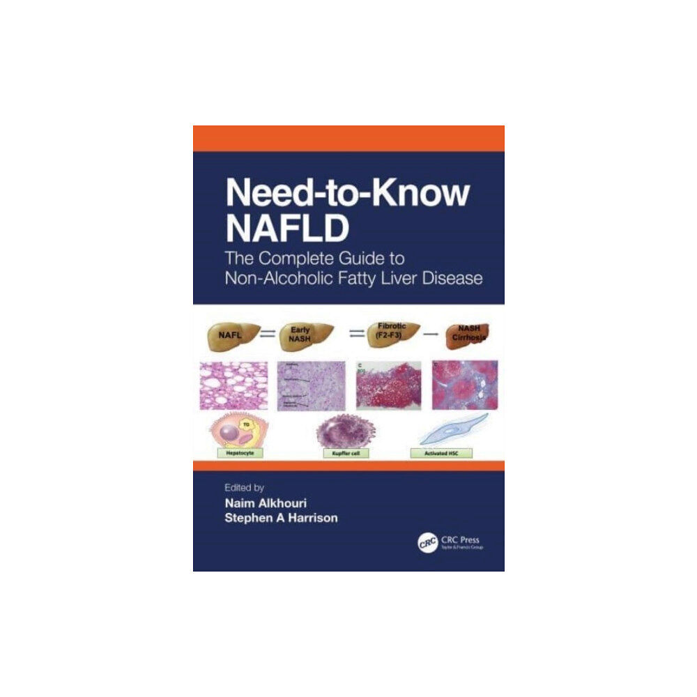 Taylor & francis ltd Need-to-Know NAFLD (häftad, eng)