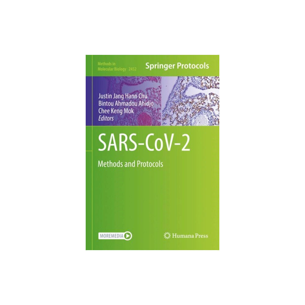 Springer-Verlag New York Inc. SARS-CoV-2 (inbunden, eng)