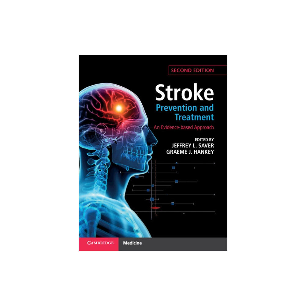 Cambridge University Press Stroke Prevention and Treatment (inbunden, eng)