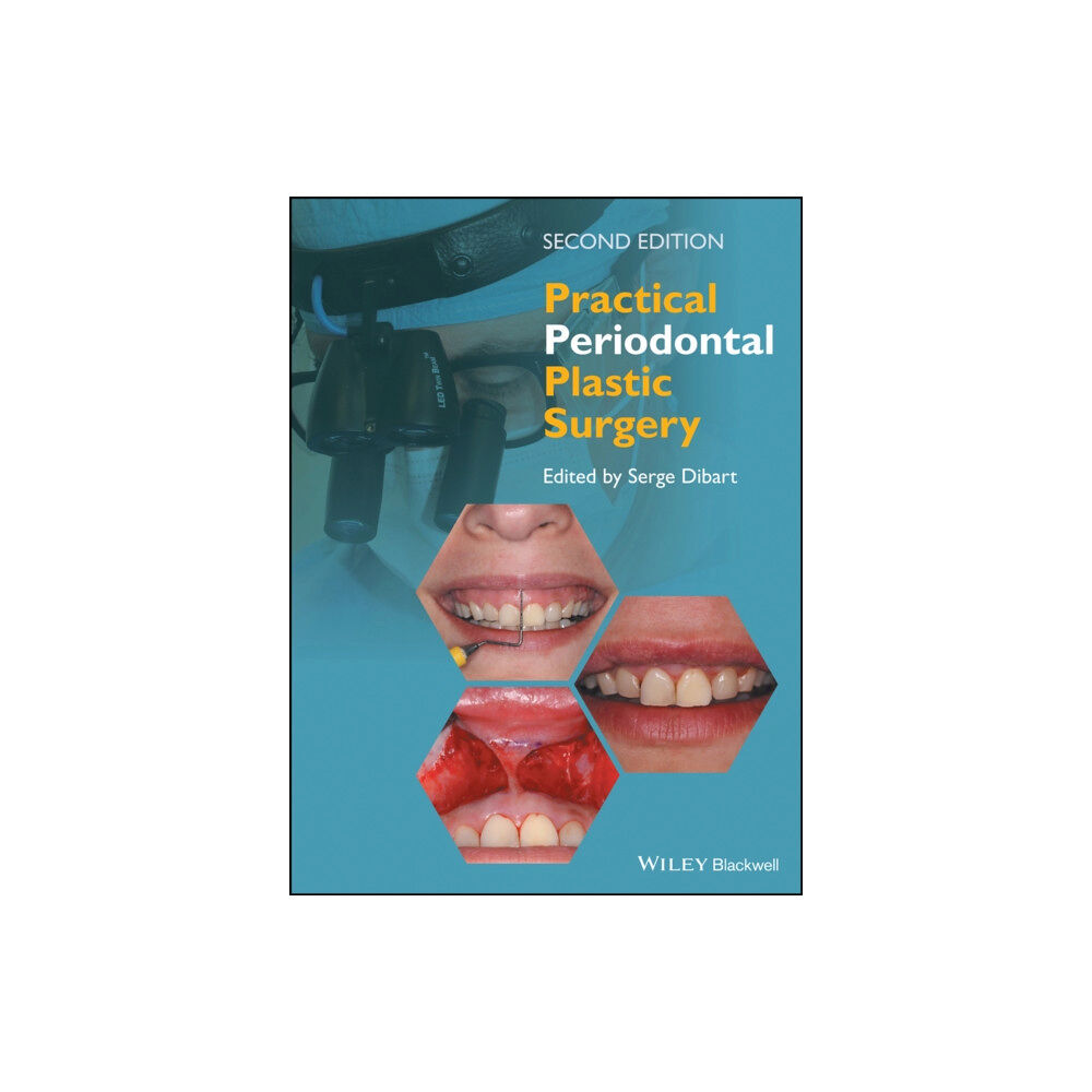 John Wiley And Sons Ltd Practical Periodontal Plastic Surgery (inbunden, eng)