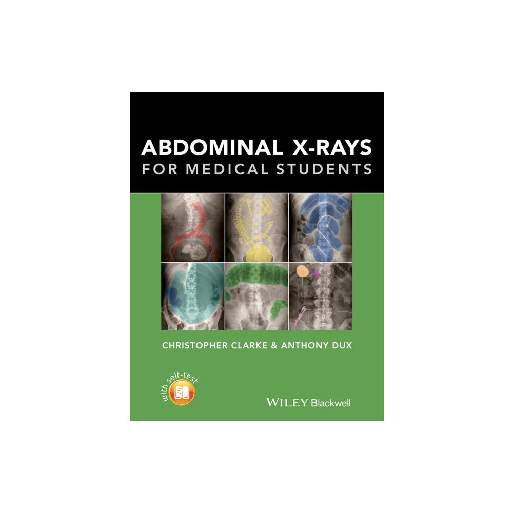 John Wiley And Sons Ltd Abdominal X-rays for Medical Students (häftad, eng)