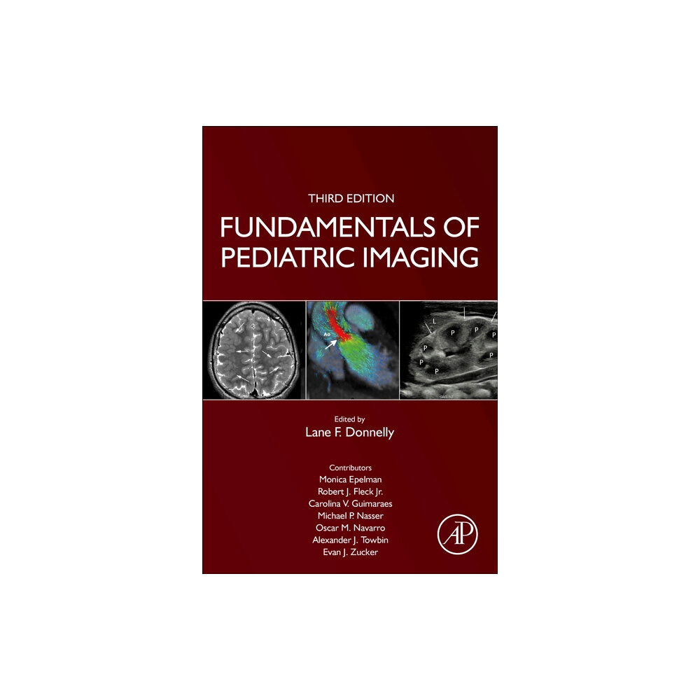 Elsevier Science Publishing Co Inc Fundamentals of Pediatric Imaging (inbunden, eng)