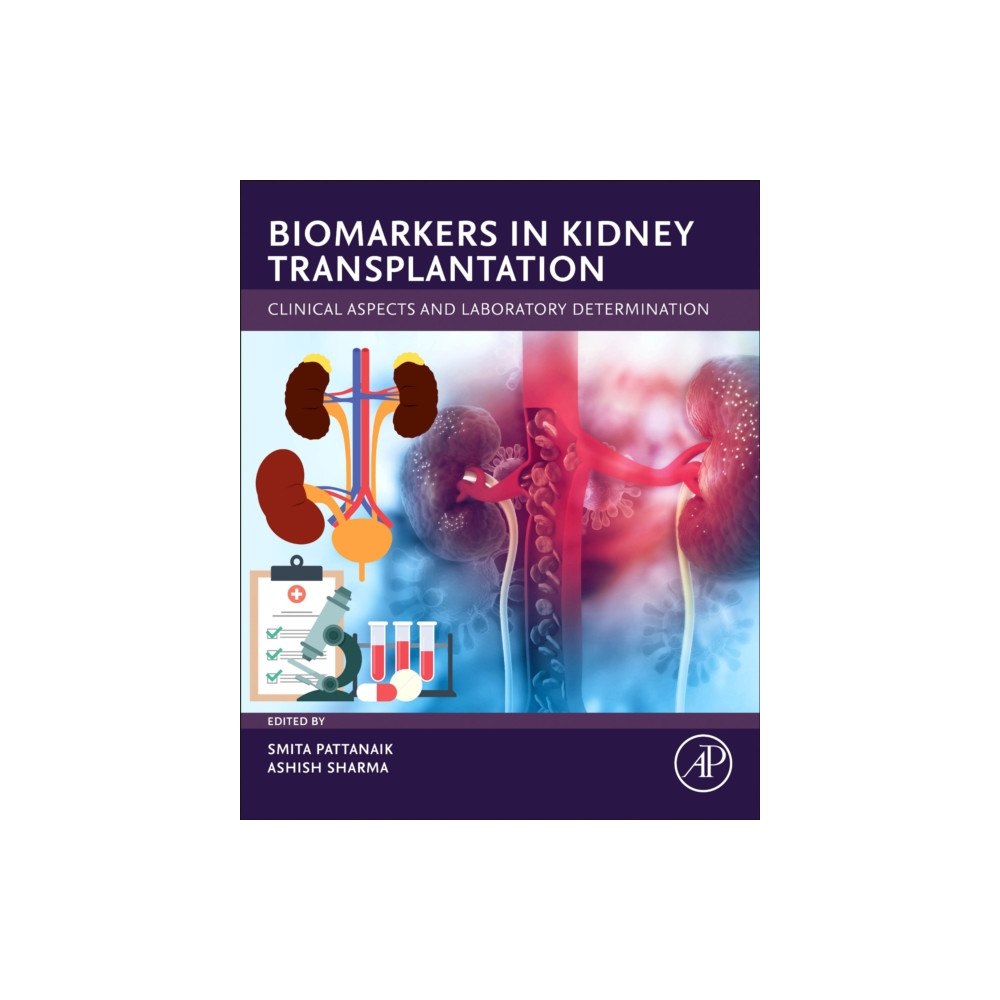 Elsevier Science Publishing Co Inc Biomarkers in Kidney Transplantation (häftad, eng)