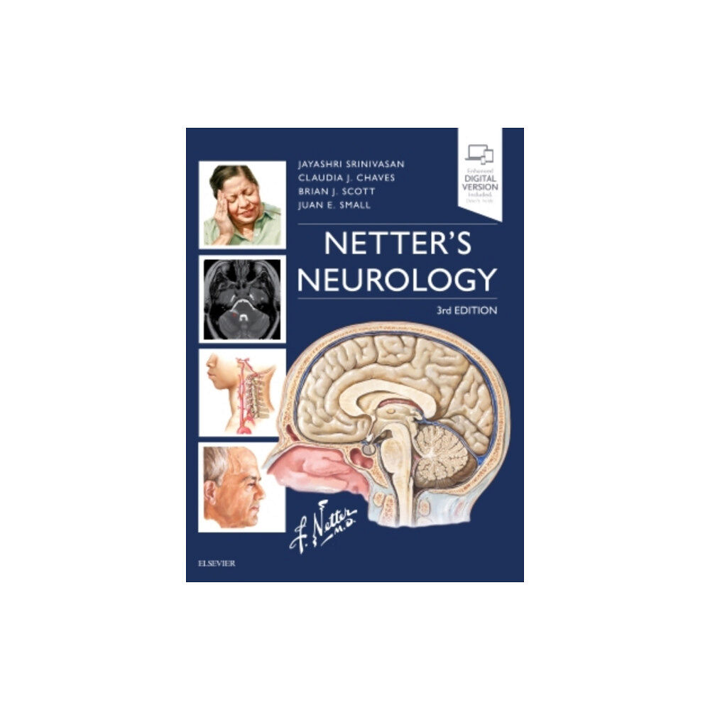 Elsevier - Health Sciences Division Netter's Neurology (inbunden, eng)