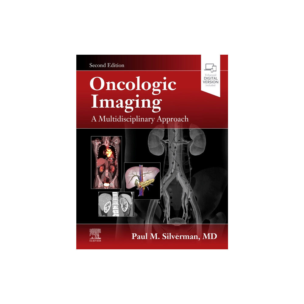 Elsevier - Health Sciences Division Oncologic Imaging: A Multidisciplinary Approach (inbunden, eng)