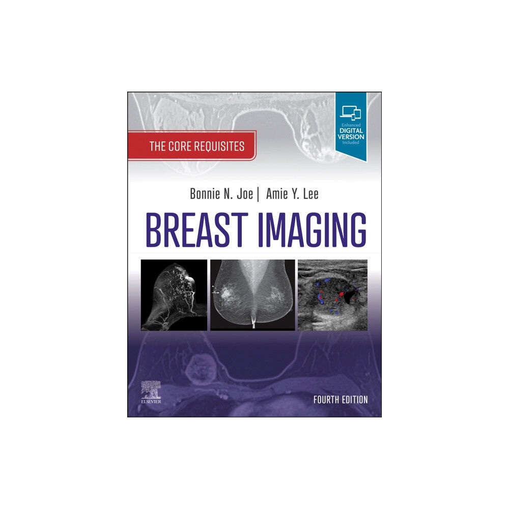 Elsevier - Health Sciences Division Breast Imaging (häftad, eng)