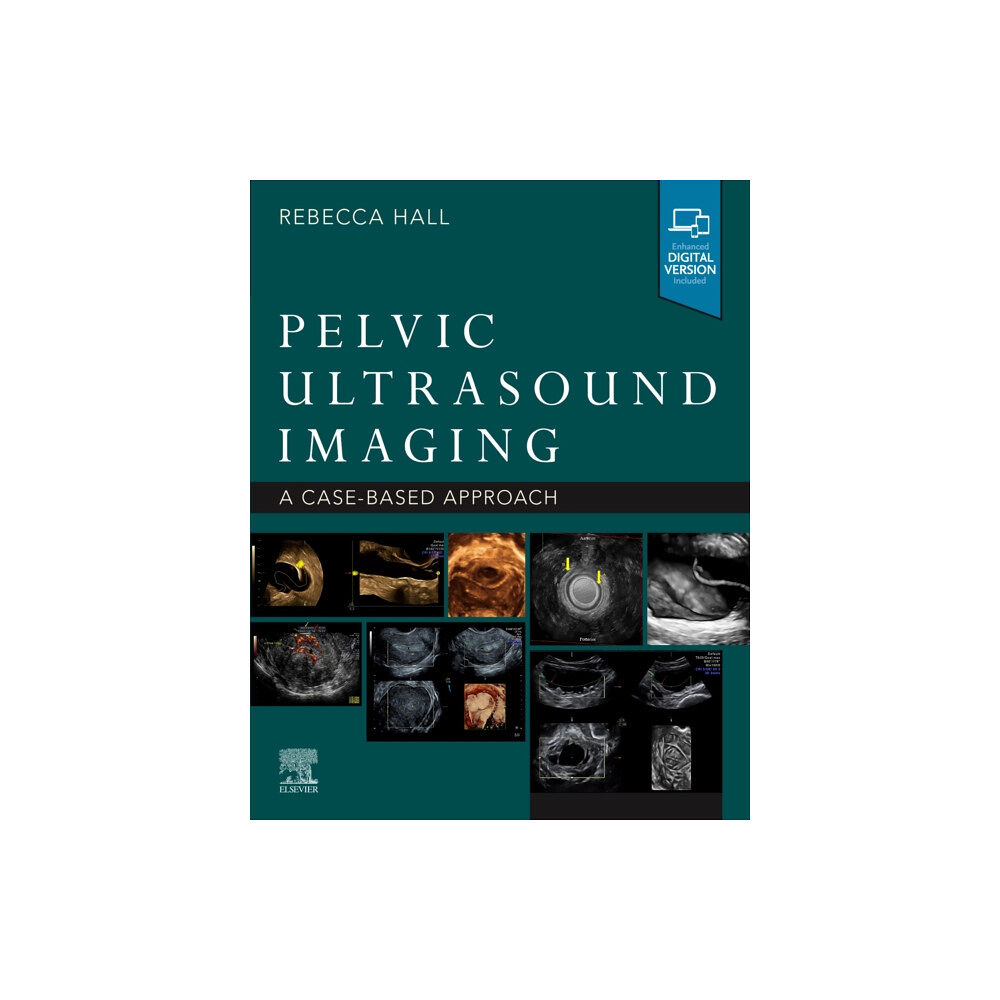 Elsevier - Health Sciences Division Pelvic Ultrasound Imaging (häftad, eng)