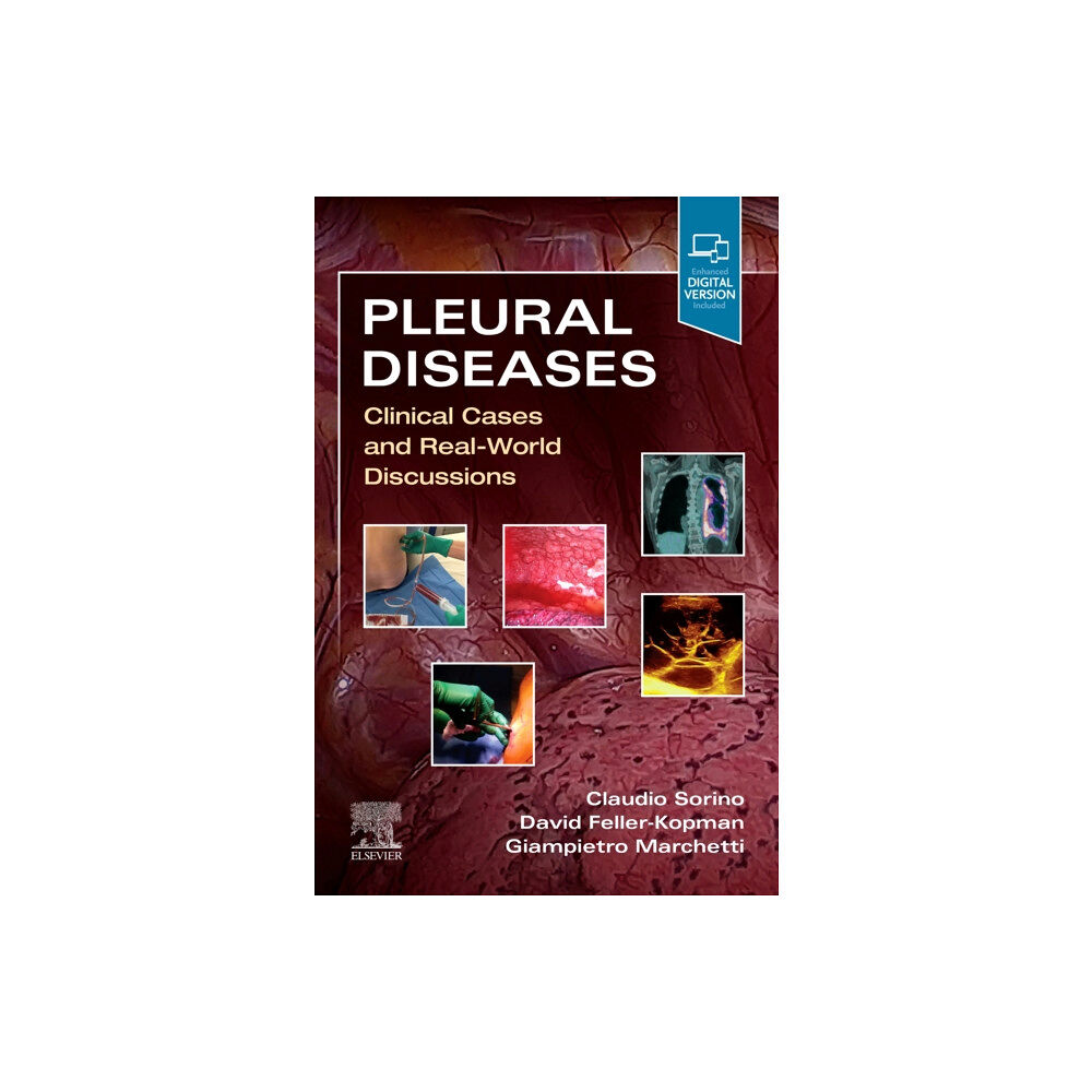 Elsevier - Health Sciences Division Pleural Diseases (häftad, eng)