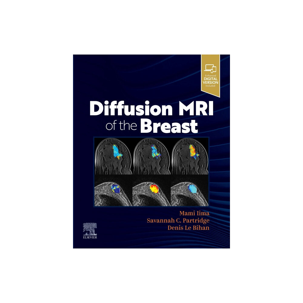 Elsevier - Health Sciences Division Diffusion MRI of the Breast (häftad, eng)