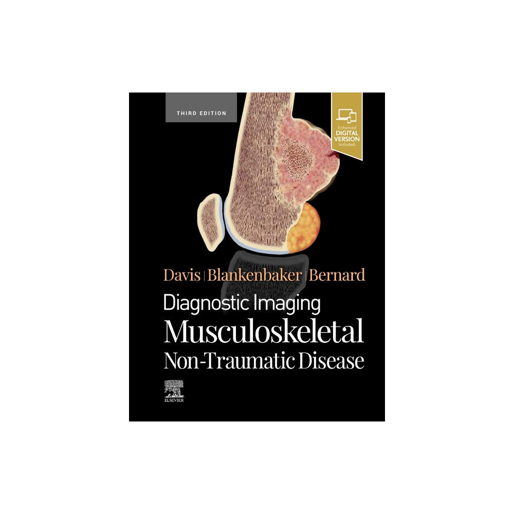 Elsevier - Health Sciences Division Diagnostic Imaging: Musculoskeletal Non-Traumatic Disease (inbunden, eng)