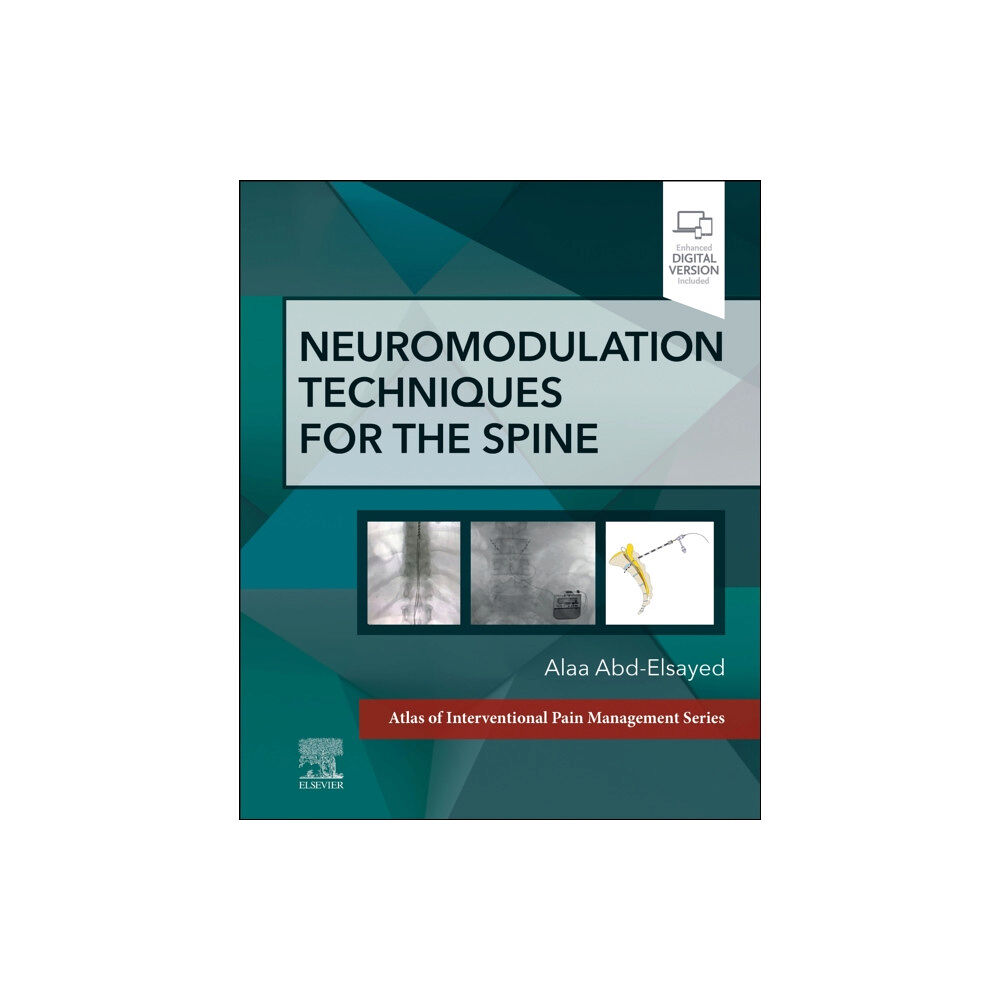 Elsevier - Health Sciences Division Neuromodulation Techniques for the Spine (inbunden, eng)