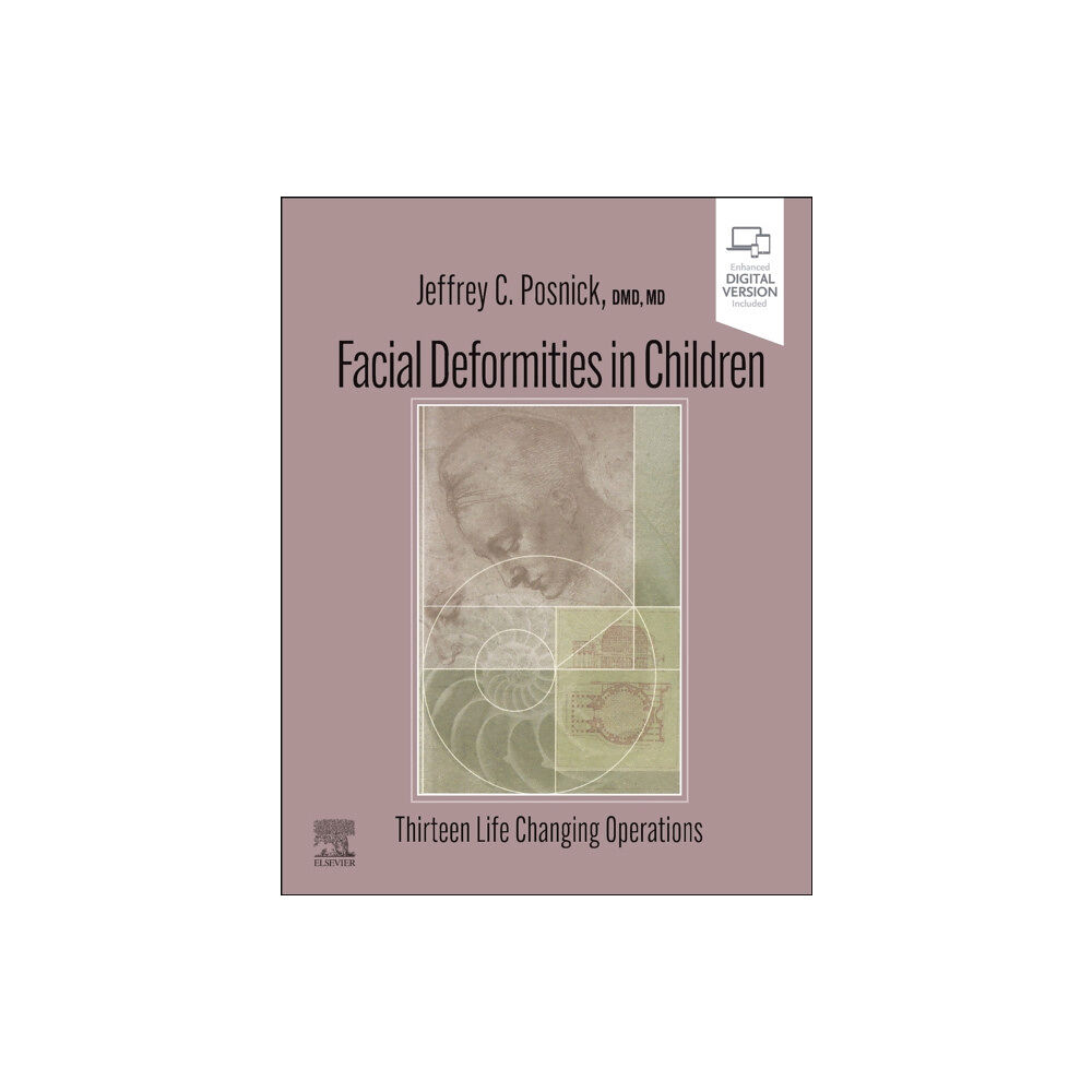 Elsevier - Health Sciences Division Facial Deformities in Children (inbunden, eng)