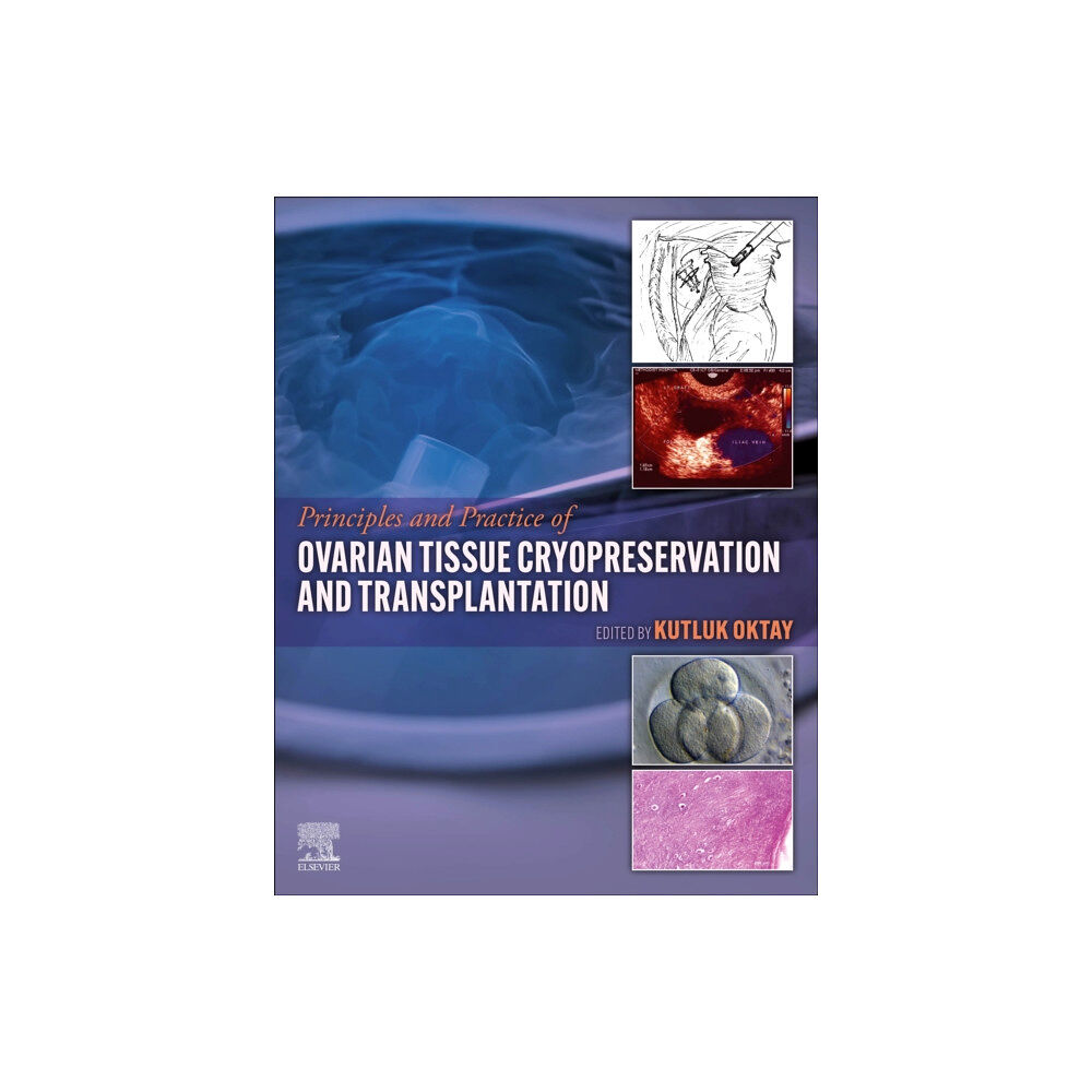 Elsevier - Health Sciences Division Principles and Practice of Ovarian Tissue Cryopreservation and Transplantation (inbunden, eng)