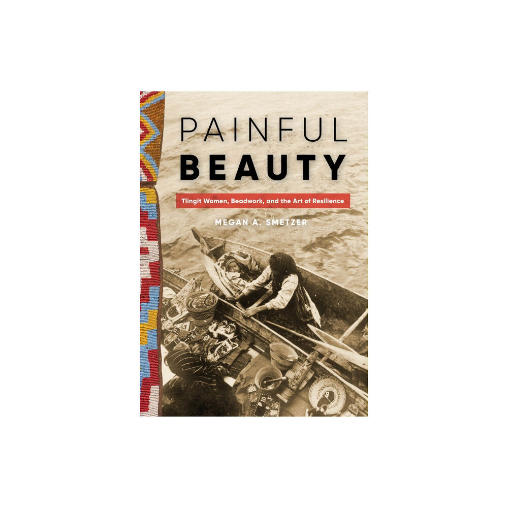 University of Washington Press Painful Beauty (inbunden, eng)