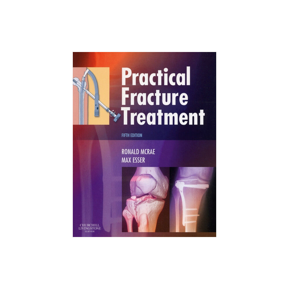 Elsevier Health Sciences Practical Fracture Treatment (häftad, eng)