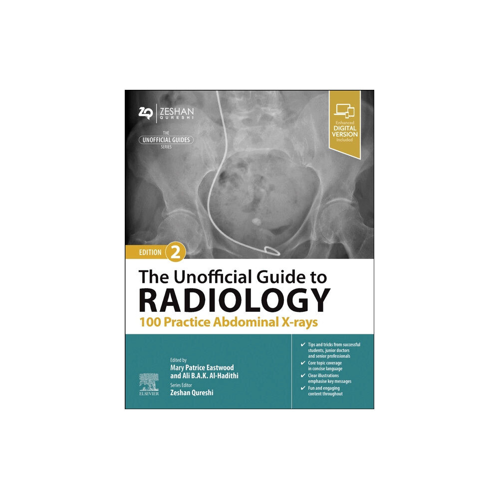 Elsevier Health Sciences The Unofficial Guide to Radiology: 100 Practice Abdominal X-rays (häftad, eng)