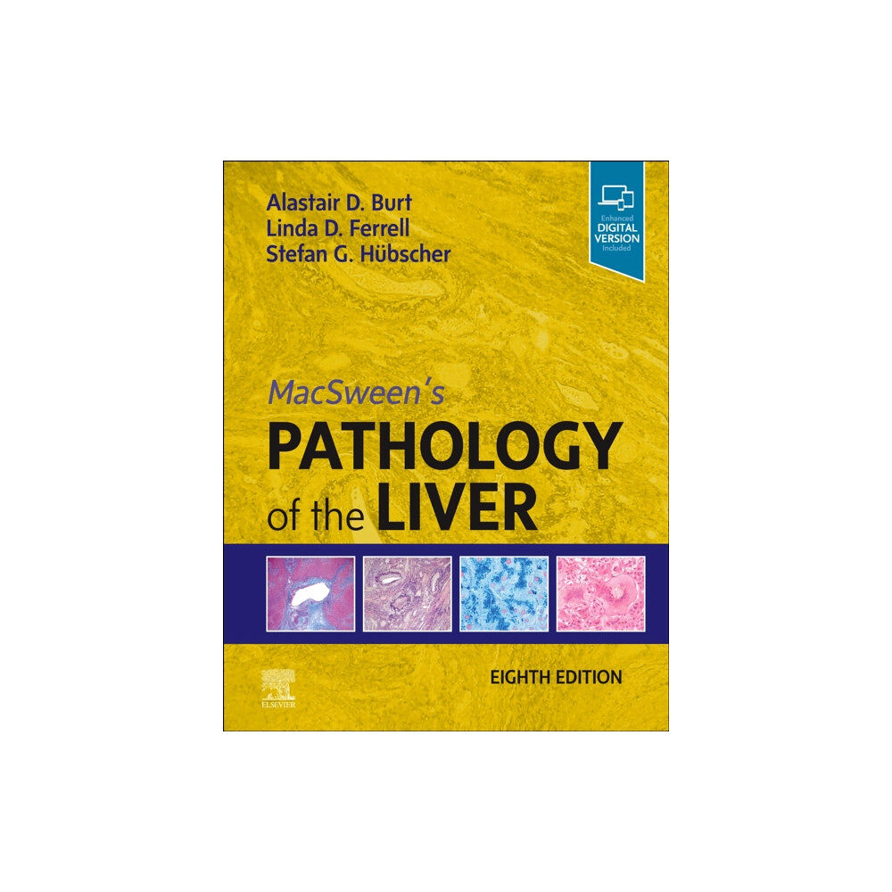 Elsevier Health Sciences MacSween's Pathology of the Liver (inbunden, eng)