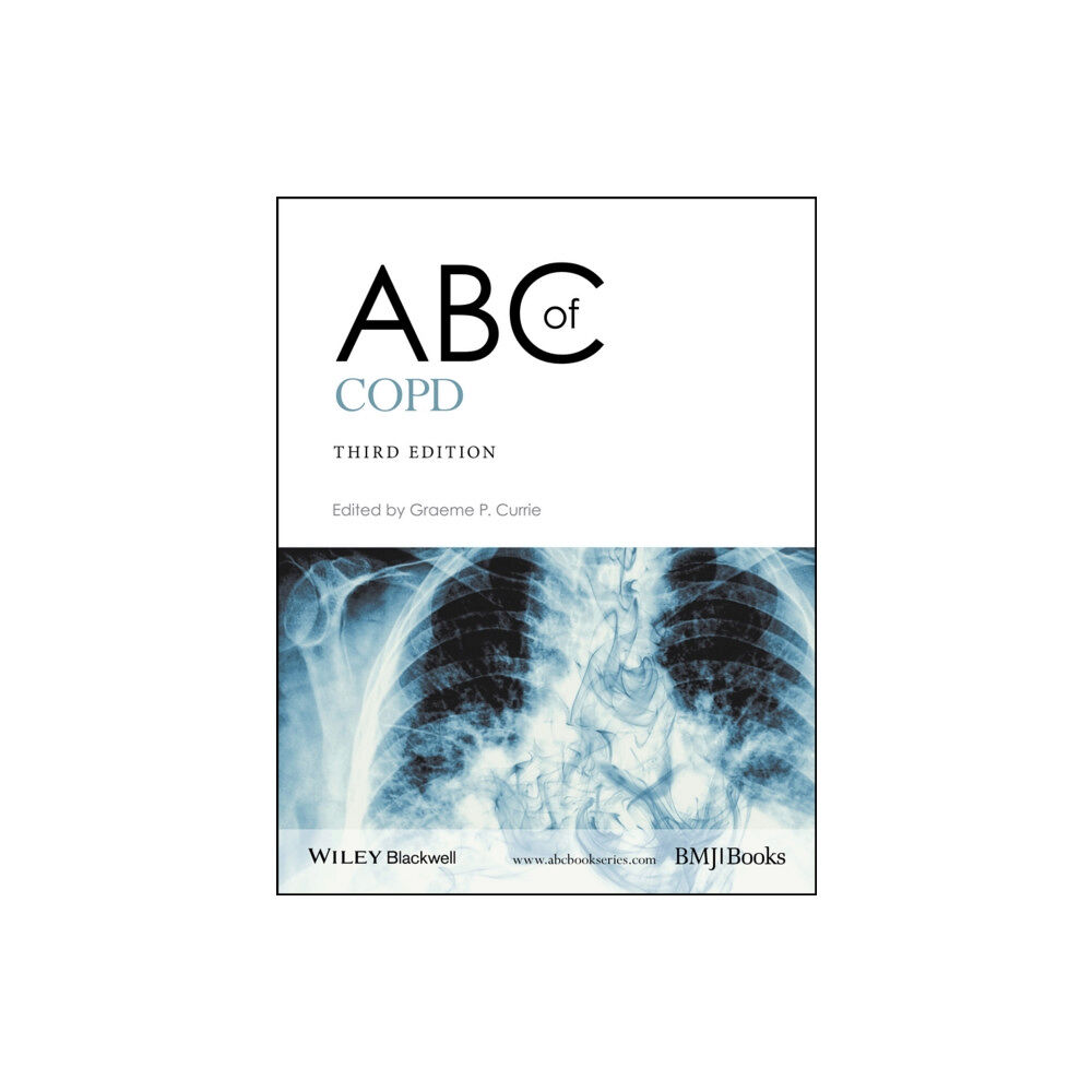 John Wiley And Sons Ltd ABC of COPD (häftad, eng)