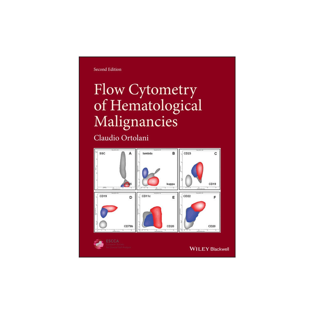 John Wiley And Sons Ltd Flow Cytometry of Hematological Malignancies (inbunden, eng)