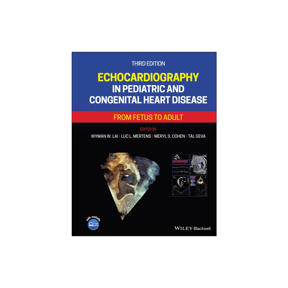 John Wiley And Sons Ltd Echocardiography in Pediatric and Congenital Heart Disease (inbunden, eng)