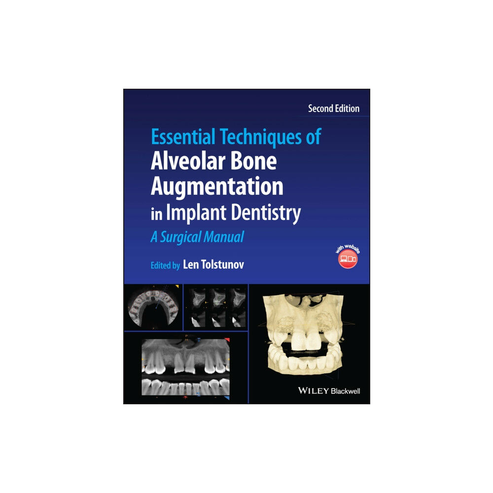 John Wiley And Sons Ltd Essential Techniques of Alveolar Bone Augmentation in Implant Dentistry (inbunden, eng)