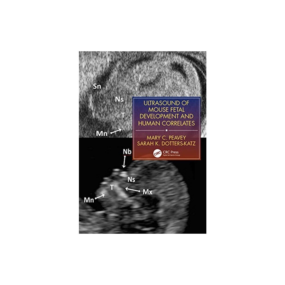 Taylor & francis ltd Ultrasound of Mouse Fetal Development and Human Correlates (häftad, eng)