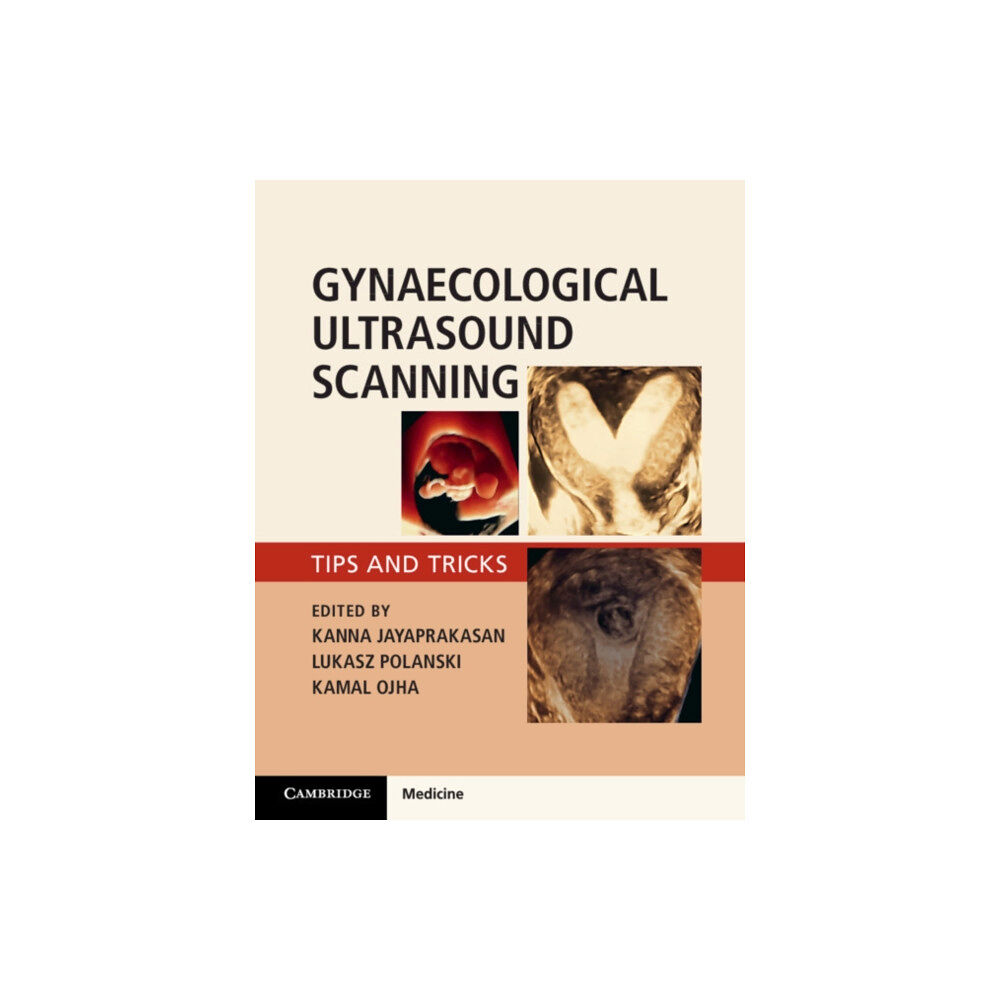 Cambridge University Press Gynaecological Ultrasound Scanning (häftad, eng)