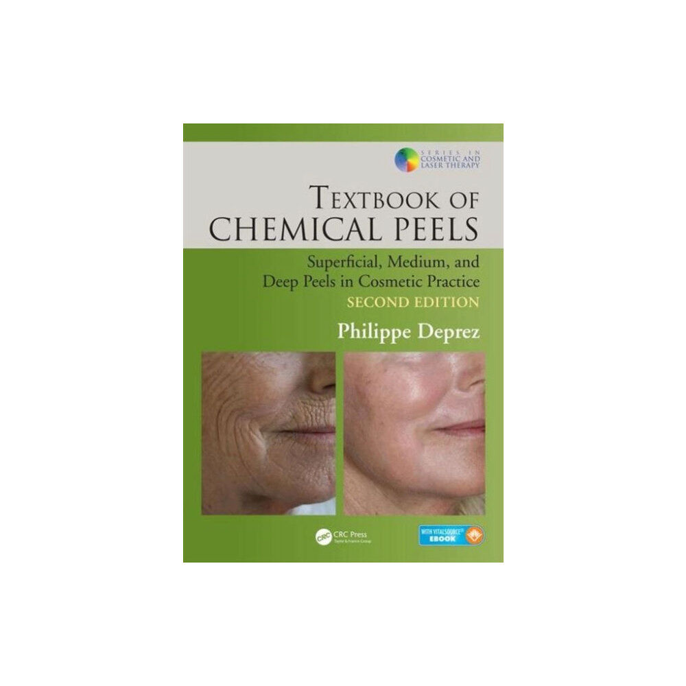 Taylor & francis inc Textbook of Chemical Peels (inbunden, eng)