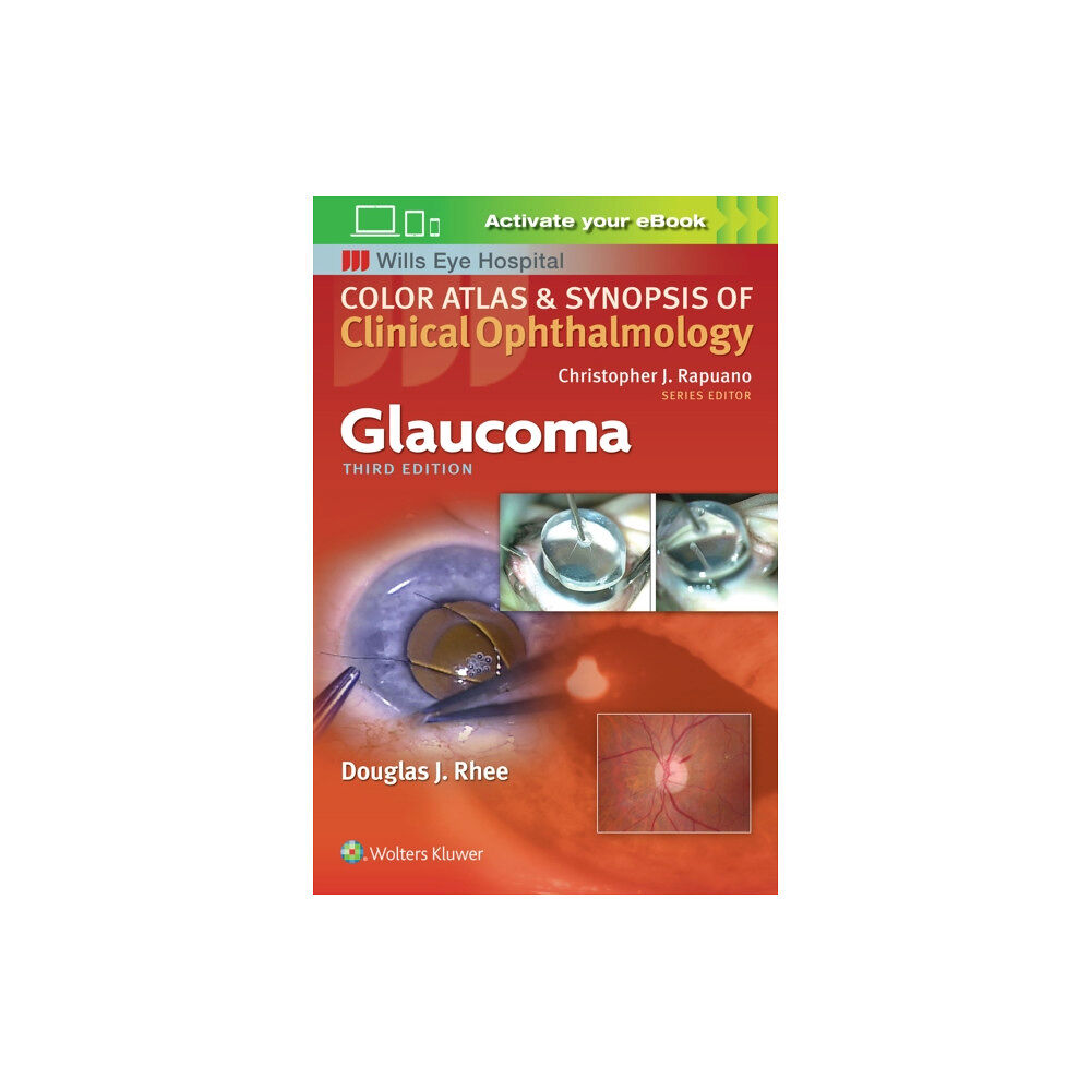 Lippincott Williams and Wilkins Glaucoma (häftad, eng)