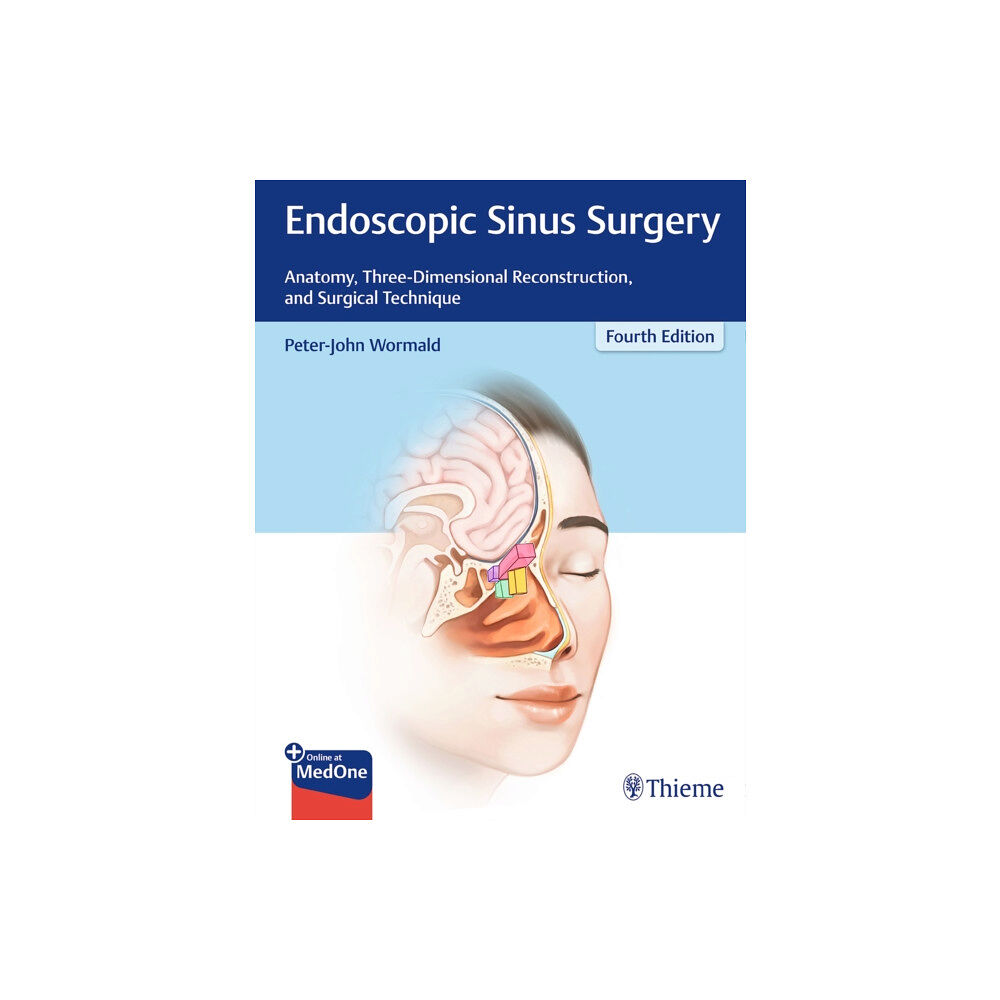 Thieme Medical Publishers Inc Endoscopic Sinus Surgery (inbunden, eng)