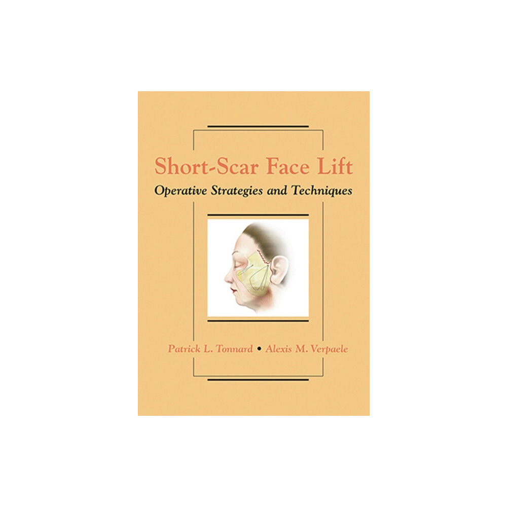 Thieme Medical Publishers Inc Short-Scar Face Lift (inbunden, eng)