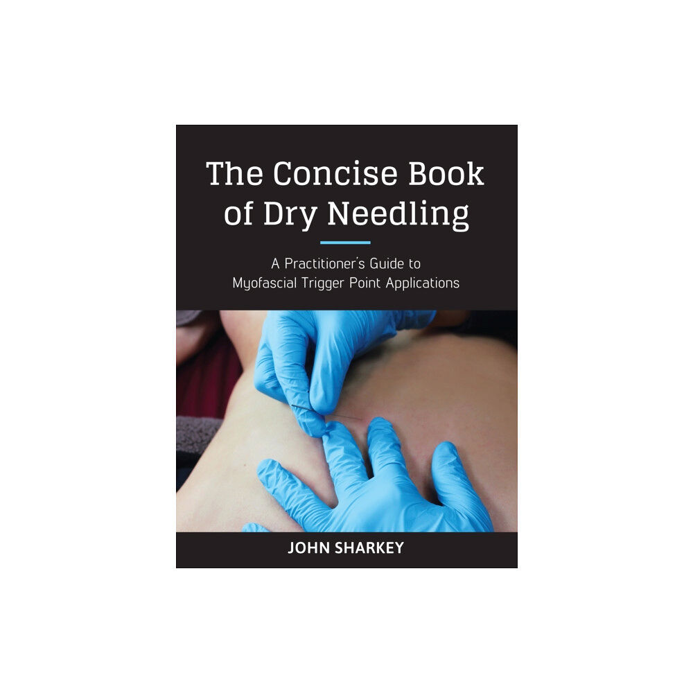 North Atlantic Books,U.S. The Concise Book of Dry Needling (häftad, eng)