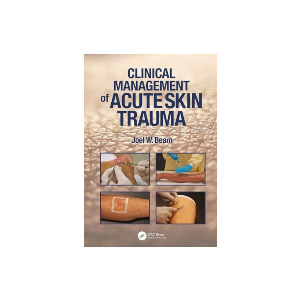 SLACK  Incorporated Clinical Management of Acute Skin Trauma (häftad, eng)