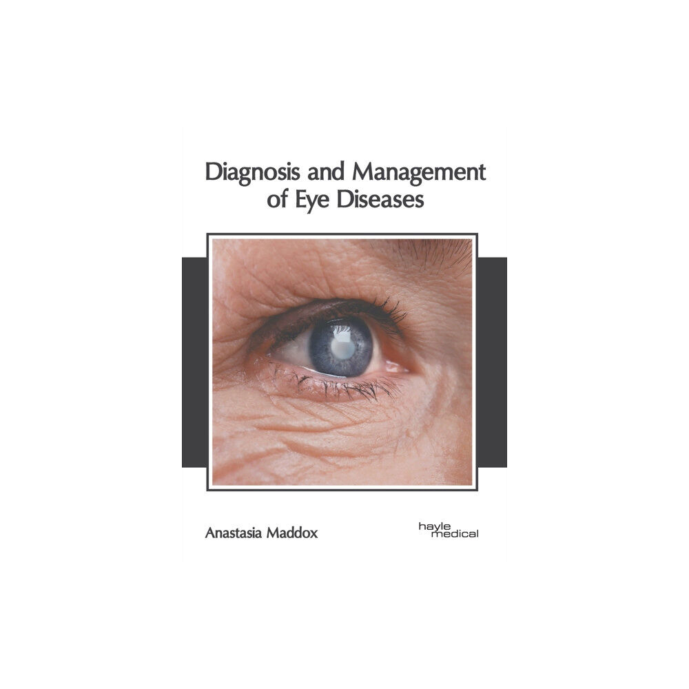 Hayle Medical Diagnosis and Management of Eye Diseases (inbunden, eng)