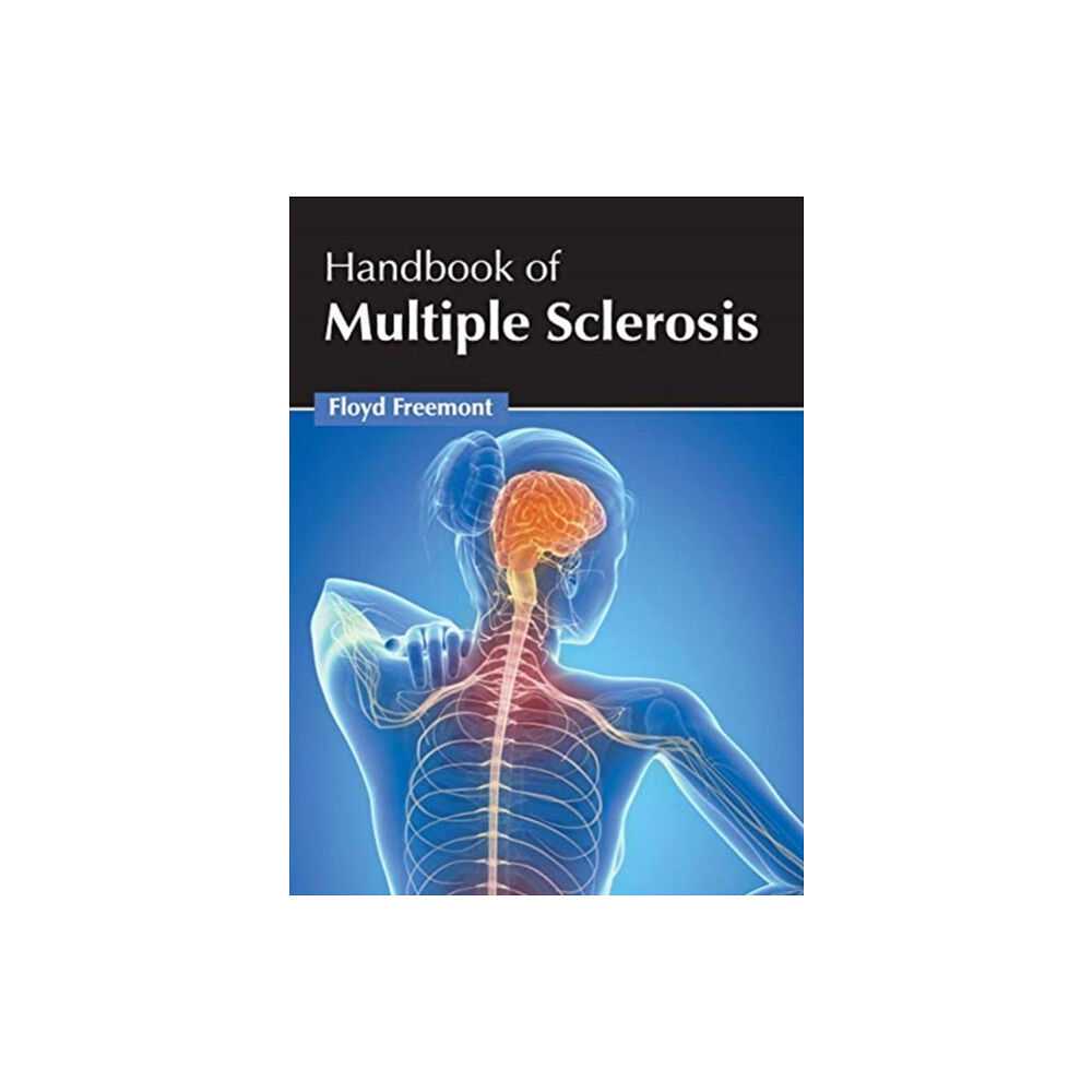 Foster Academics Handbook of Multiple Sclerosis (inbunden, eng)