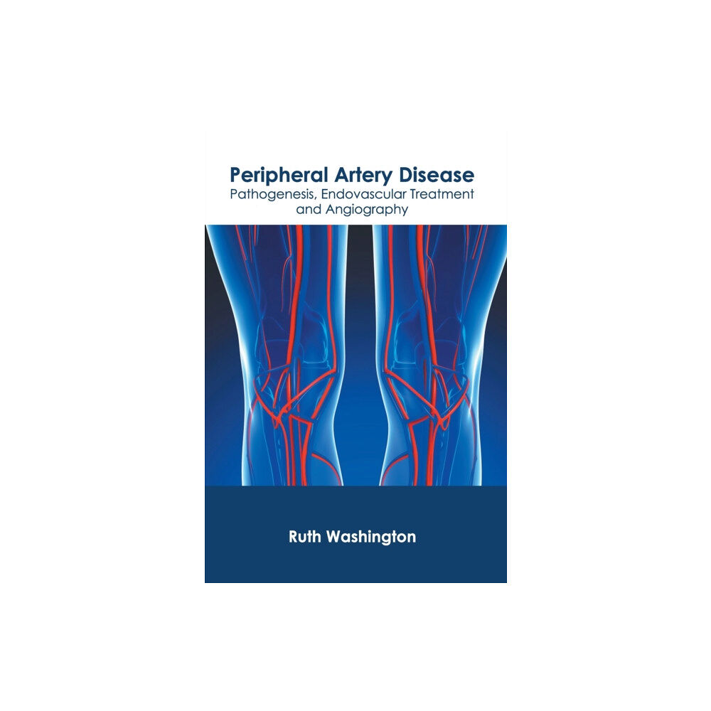 Foster Academics Peripheral Artery Disease: Pathogenesis, Endovascular Treatment and Angiography (inbunden, eng)