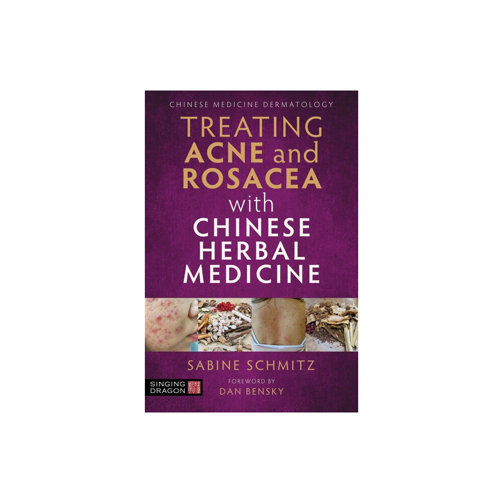 Jessica kingsley publishers Treating Acne and Rosacea with Chinese Herbal Medicine (häftad, eng)