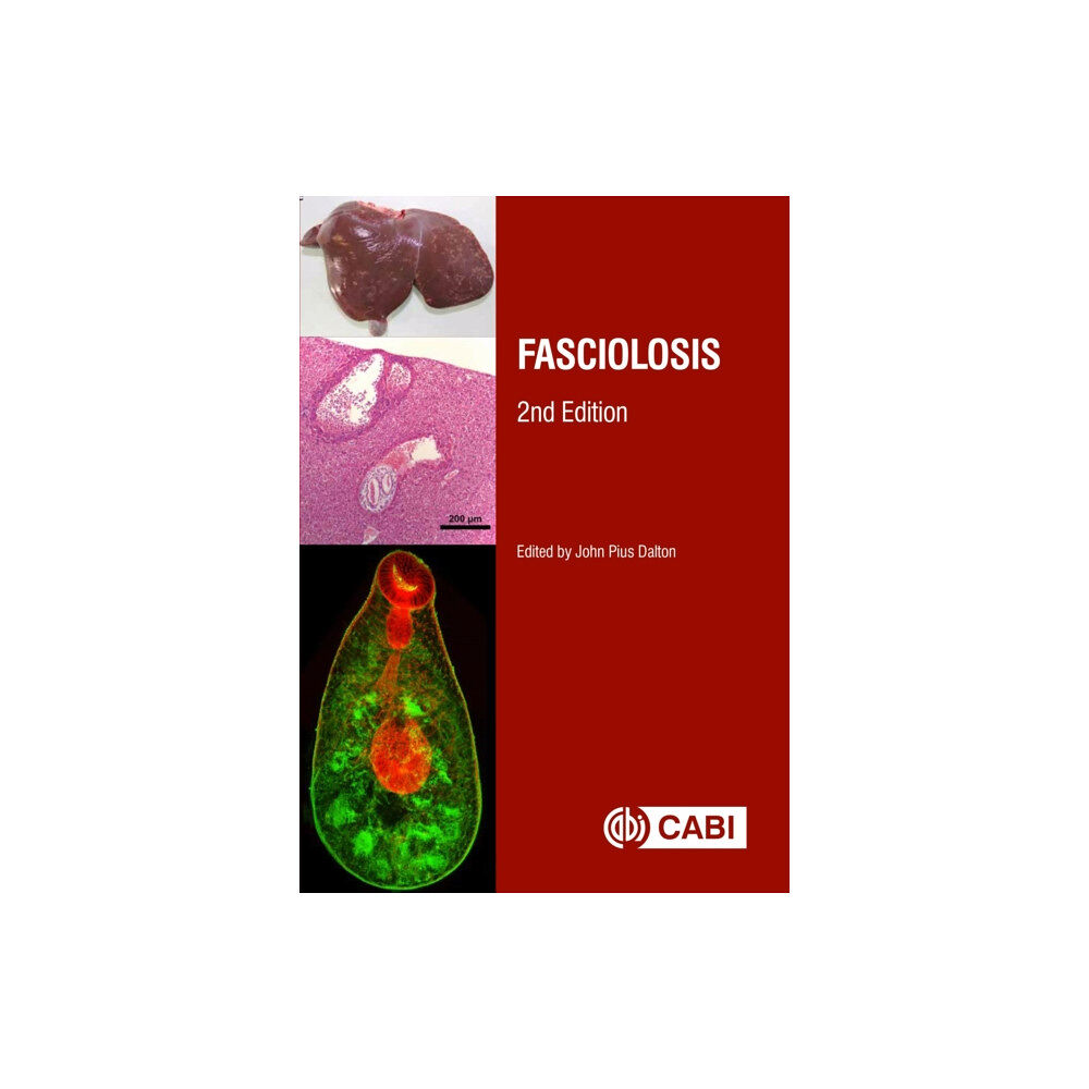 CABI Publishing Fasciolosis (inbunden, eng)