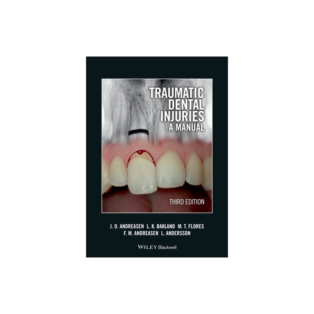 John Wiley And Sons Ltd Traumatic Dental Injuries (häftad, eng)