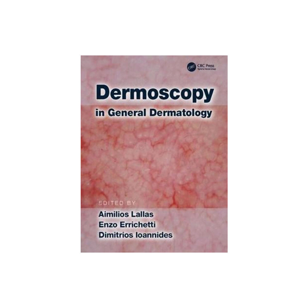 Taylor & francis ltd Dermoscopy in General Dermatology (inbunden, eng)