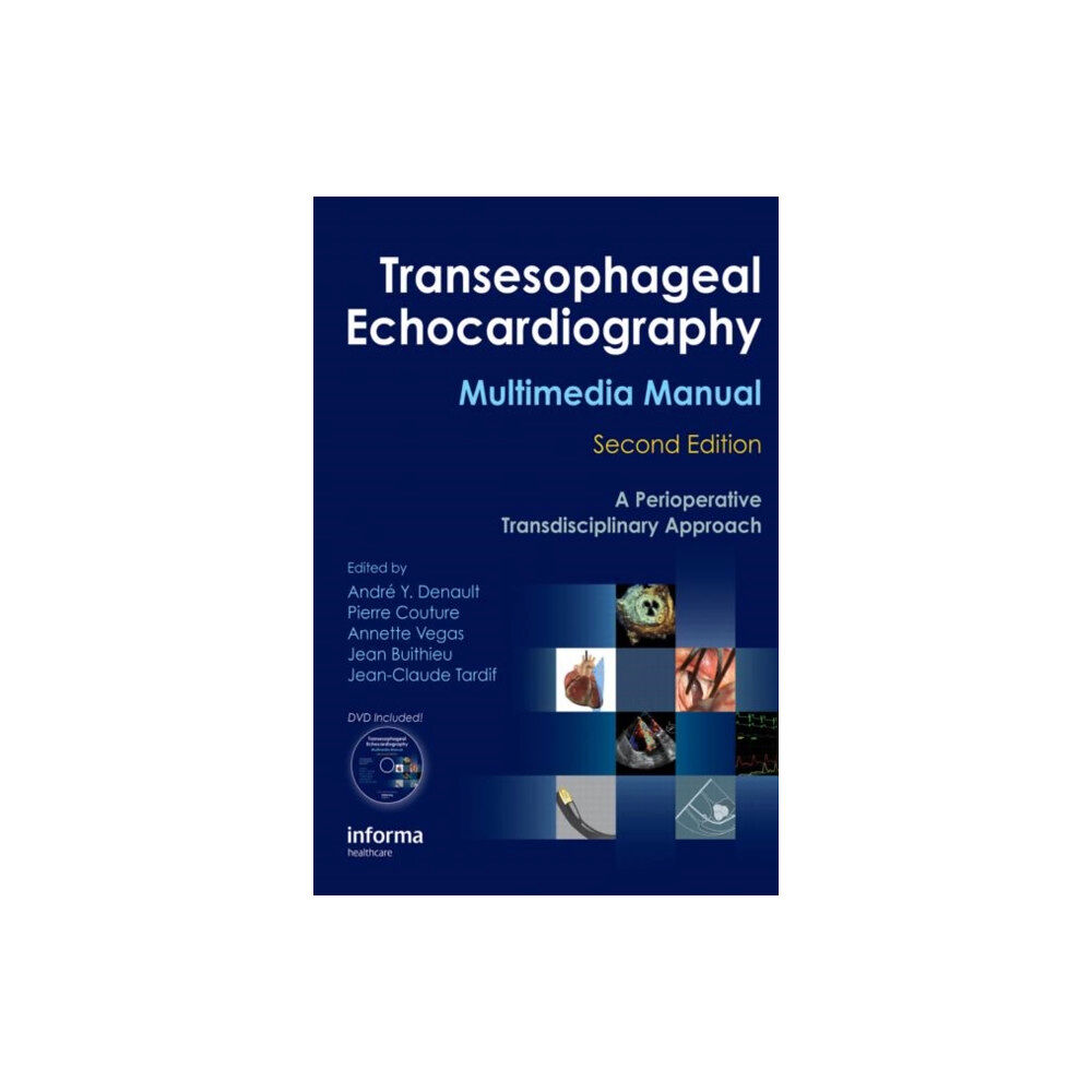 Taylor & francis inc Transesophageal Echocardiography Multimedia Manual (inbunden, eng)